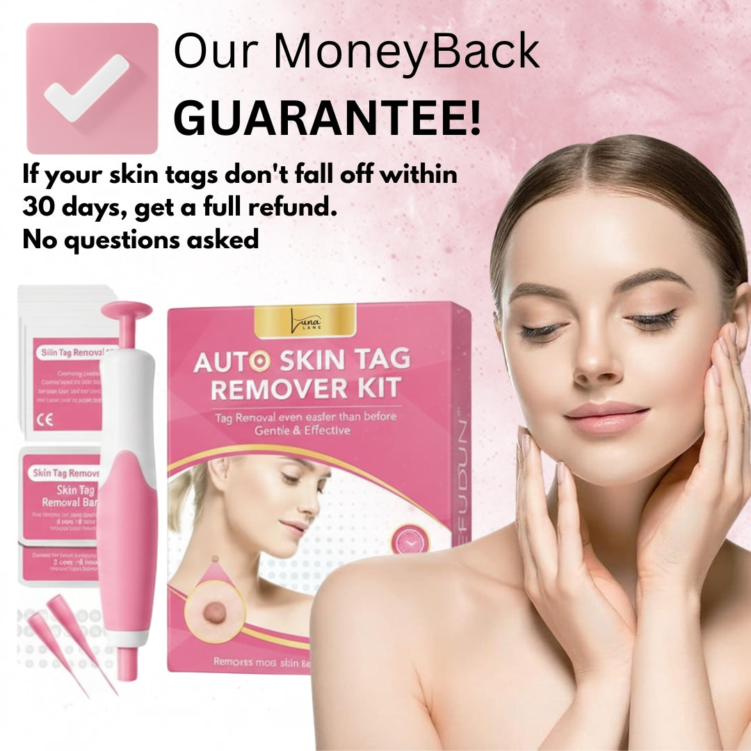 LunaSmooth™ Skin Tag Removal Kit