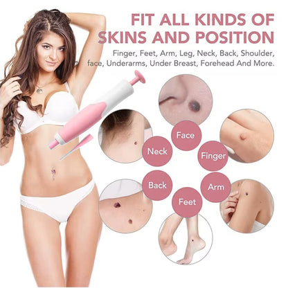 LunaSmooth™ Skin Tag Removal Kit