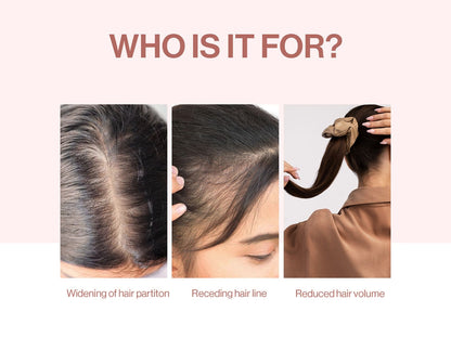 LunaLane™ Follicle Path Roller