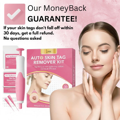 LunaSmooth™ Skin Tag Removal Kit