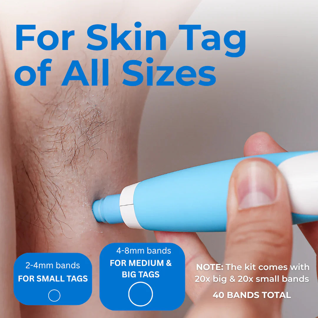 LunaSmooth™ Skin Tag Removal Kit
