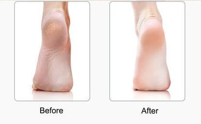LunaWand™ Nuve Foot Care Magic