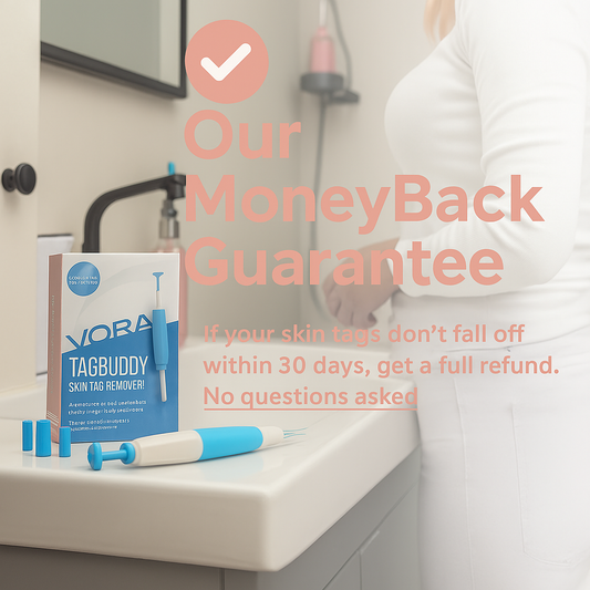 LunaSmooth™ Skin Tag Removal Kit